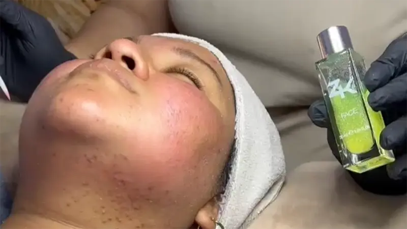 Peeling JHL